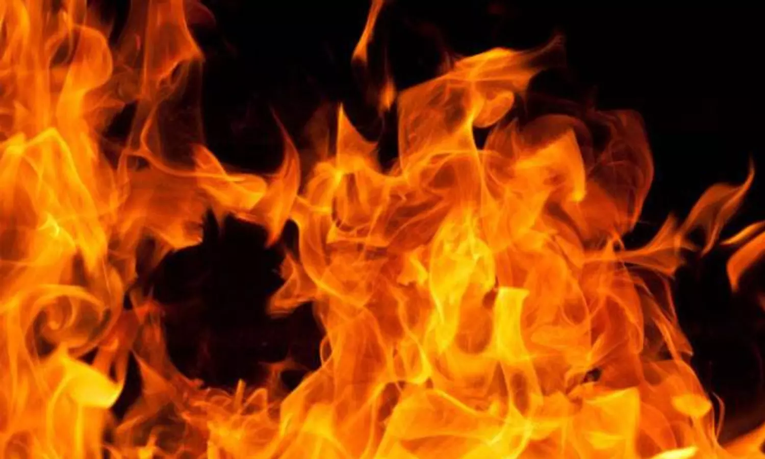 MP News: भयावह घटना, आखों के सामने ही जल गया पूरा संसार, छटपटा कर रह गए लोग